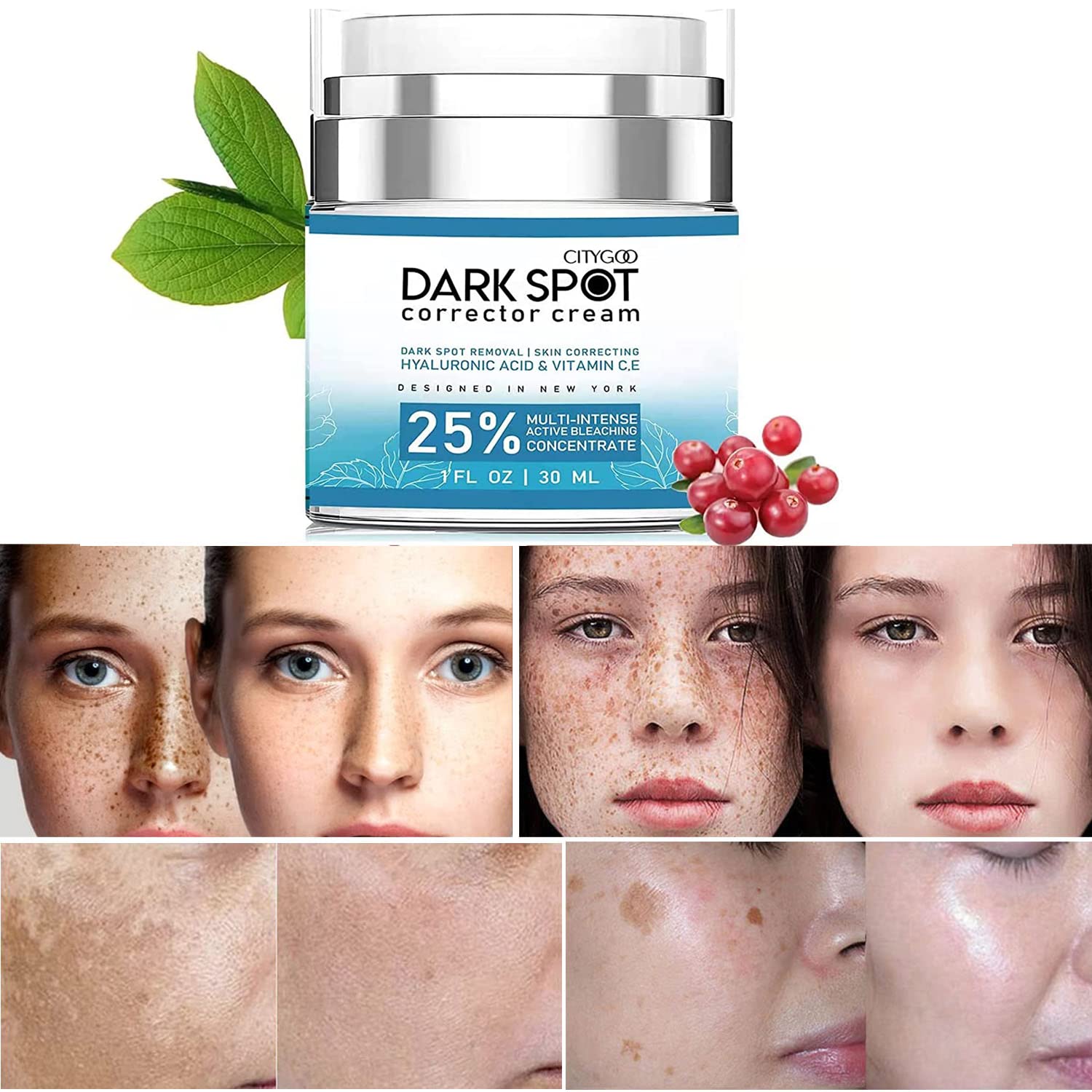 Citygoo Dark Spot Remover Cream For Face Body Natural Skin Care For