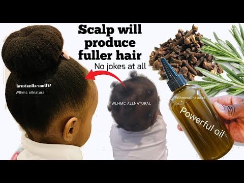 Discover More Than 77 Clove Oil For Hair Growth Super Hot Ceg Edu Vn